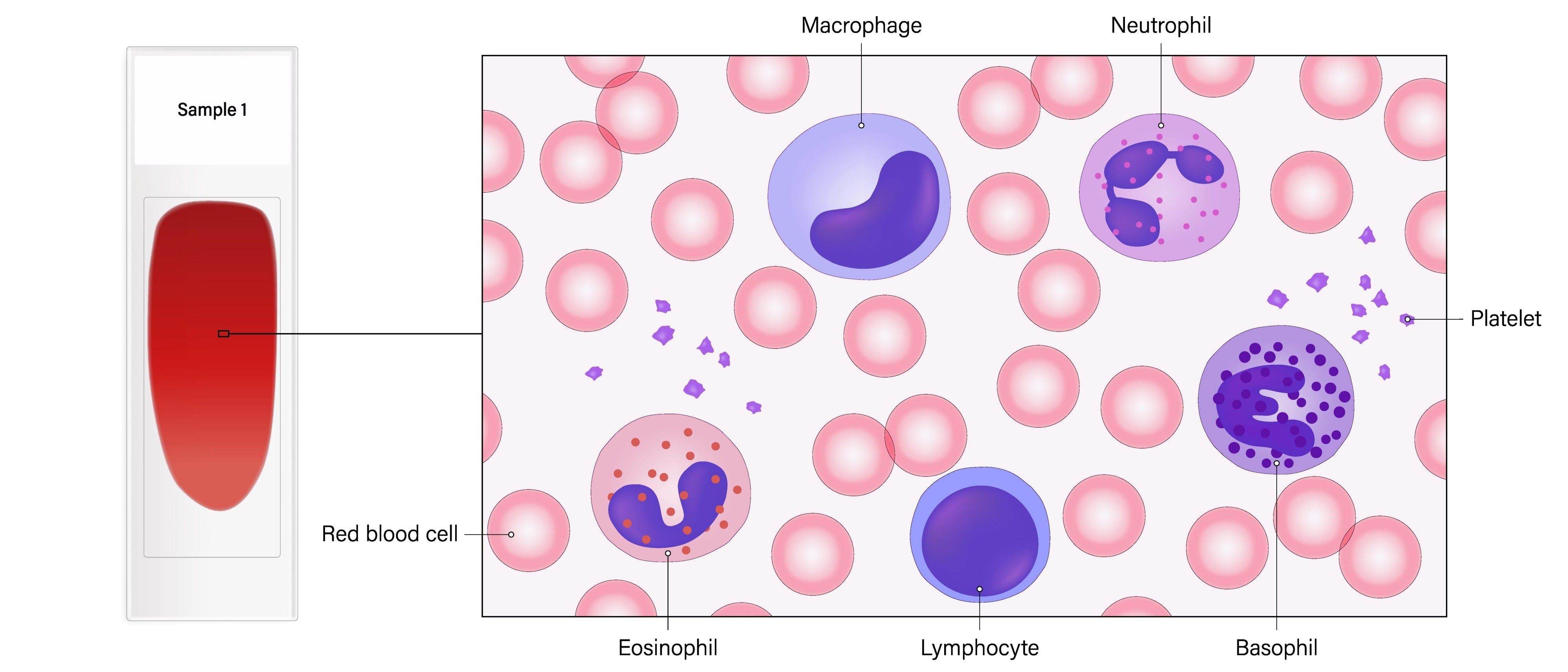 Illustration of cell-free transcriptome research